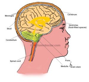 Health and Medical ArticlesLeptomeningitis - Health and Medical Articles