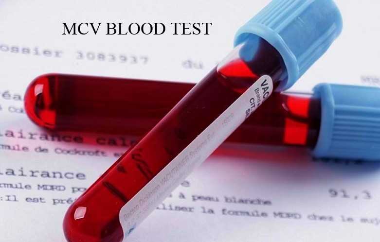 What Does A High Mcv In A Blood Test Mean