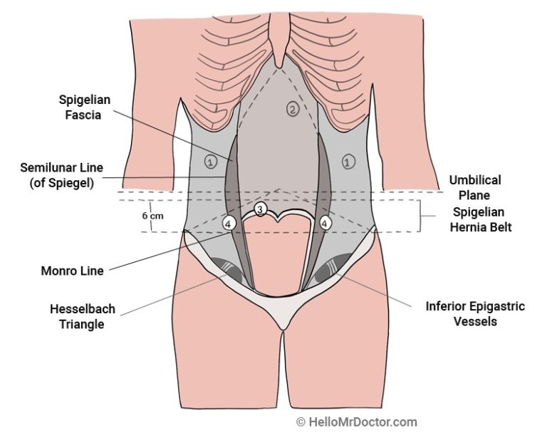 Spigelian Hernia Pictures Location Causes Treatment